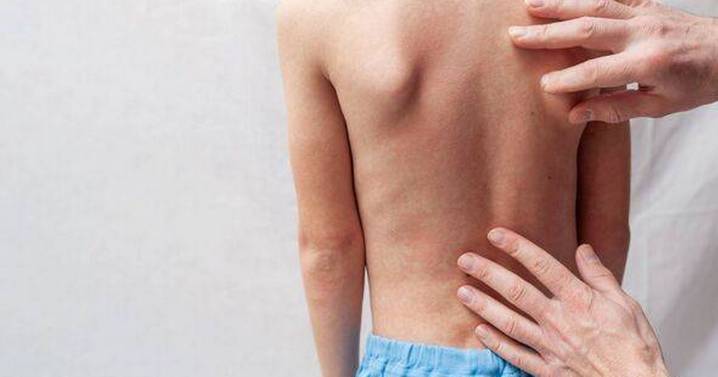 UKHSA warns of illness 'twice as contagious as common cold'