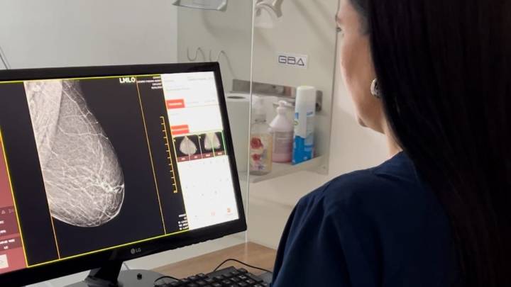 Cáncer de mama: en octubre se realizó un 140 % más de mamografías en Santa Fe