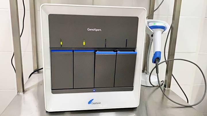 Diagnóstico oportuno de la Tuberculosis con equipos de alta tecnología, es posible en Casanare