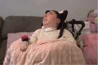 Mujer con hidranencefalia celebra 20 años