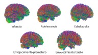Las cinco ‘edades’ del cerebro humano: hay cambios cruciales alrededor de los 9, los 32, los 66 y los 83 años