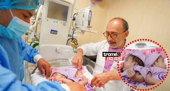 Nacen gemelitas siamesas prematuras: Son peruanas y con atención especializada y mucho amor las preparan para cirugía Pequeñas guerreras afrontan lucha por la vida. Lograron ganar peso, salieron de UC