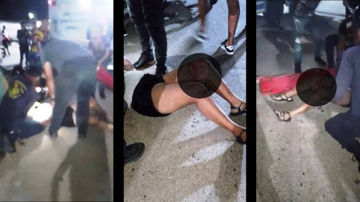 Un raspón grande de rodilla fue lo que se vio