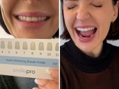 ‘Teeth reset’: 50pc off whitening kit 3.4k love