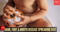 Hand, foot and mouth disease rise in the US: Doctors warn about symptoms, share prevention tips
