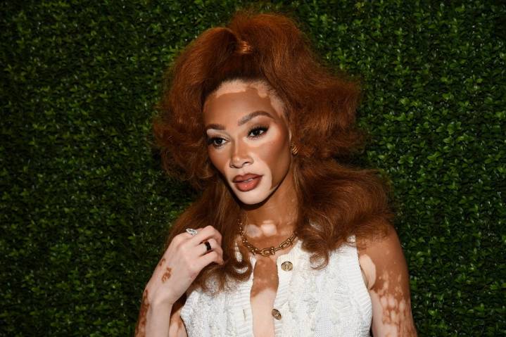 Winnie Harlow Responds To Criticism Of Her Whitney Houston Halloween Costume: ‘My Video Wasn’t Mocking Whitney’