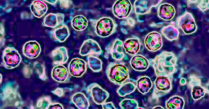 Measles warning: Highly infectious, deadly disease 'likely circulating' in Sydney years after being eliminated