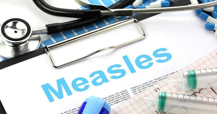 Some seniors may have developed immunity to measles