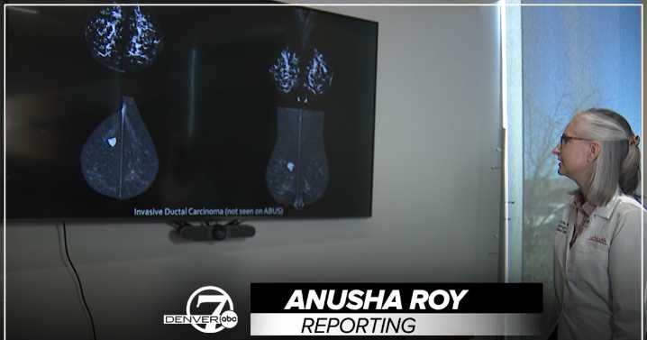 UCHealth is the first in Colorado to offer a new kind of mammogram to catch breast cancer