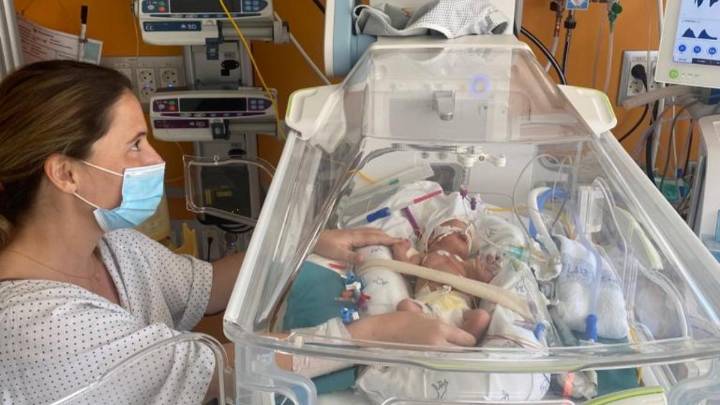 Ser padres de un bebé prematuro: “Carlota nació con 1.400 gramos y solo 31 semanas”