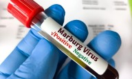 Ethiopia confirms 3 Marburg virus deaths in new outbreak