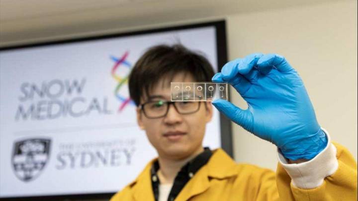 Los vasos sanguíneos impresos en 3D podrían resolver enigmas sobre los accidentes cerebrovasculares