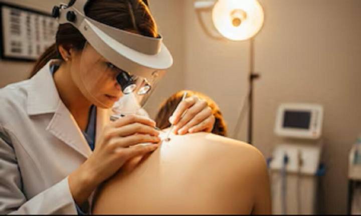 La vacuna argentina contra el cáncer de piel más agresivo ya está disponible