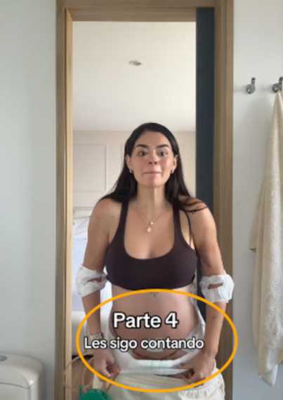 “La Segura muestra sin filtros su cicatriz tras cirugía estética y provoca debate en redes”