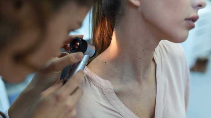 Vacuna para el melanoma: ya se comercializa la primera terapia argentina