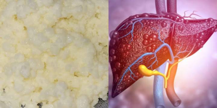 Así es como puedes consumir búlgaros para ayudar a desinflamar y combatir el hígado graso