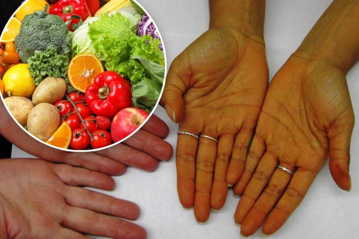 These foods can change the color of your skin if you eat too much