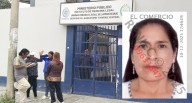 Chiclayo: mujer muere tras caer por las escaleras de su vivienda en Cruz de la Esperanza
