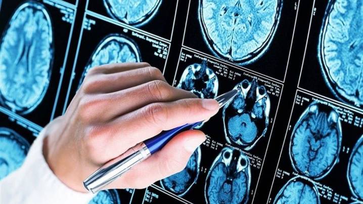 Científics de la URV fan un important descobriment sobre l'Alzheimer