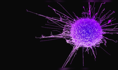 Global cancer crisis deepens, hitting the world’s most vulnerable the hardest