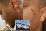 Two NYC Correction officers attacked in 4 hours at same Rikers jail -- one by menace accused of brutal subway assault: union
