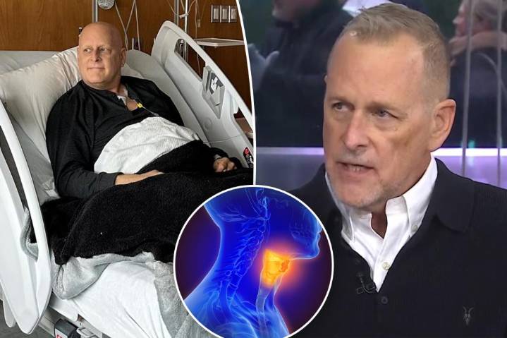 What is p16 squamous carcinoma? Dave Coulier reveals cancer diagnosis