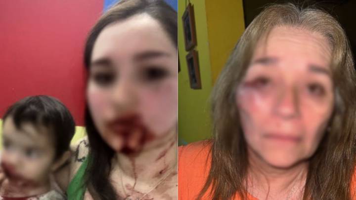 Solano: buscan a un hombre acusado de atacar violentamente a su hija, pareja y suegra