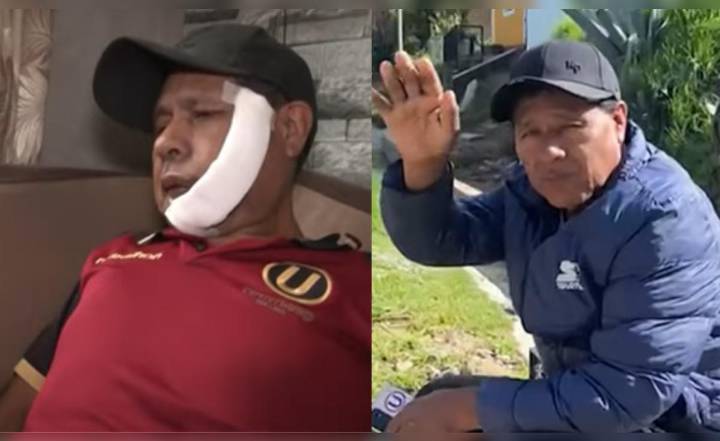Adulto mayor sufre corte en su rostro al defender a su hija de sujetos en Villa El Salvador: recibió 26 puntos de sutura