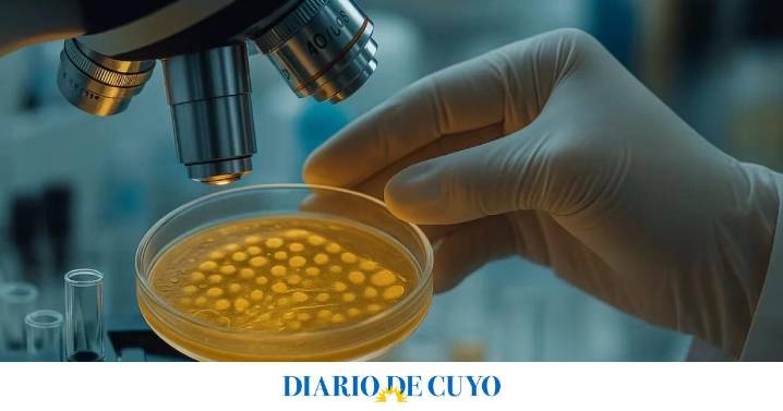 ANMAT y SENASA alertaron por una bacteria en un queso de consumo masivo