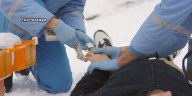 Doctors detail warning signs of frostbite, hypothermia