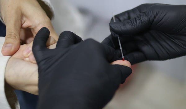 Actividades por el Día Mundial de Respuesta al VIH/SIDA