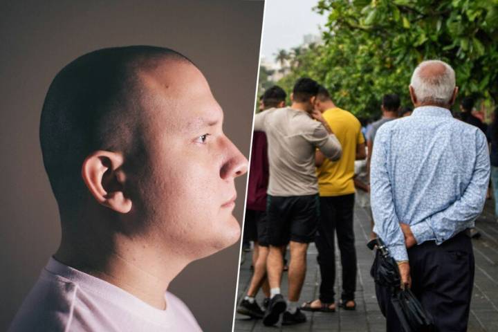 Ya sabemos exactamente por qué el estrés te deja calvo: no es solo "nervios", es un sabotaje a las células