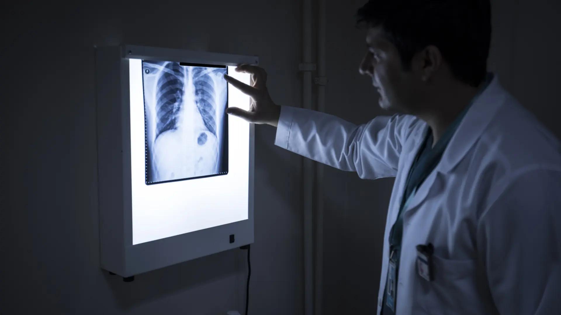 "Como si me comiera desde dentro": la enfermedad que ataca a los huesos y provoca amputaciones en el norte de Kenia