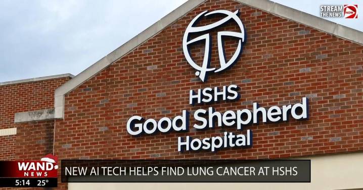 HSHS cancer patients get second chance thanks to AI