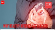 Vascular Surgeon reveals why healthy arteries get blocked, warns against 5 symptoms that are commonly ignored