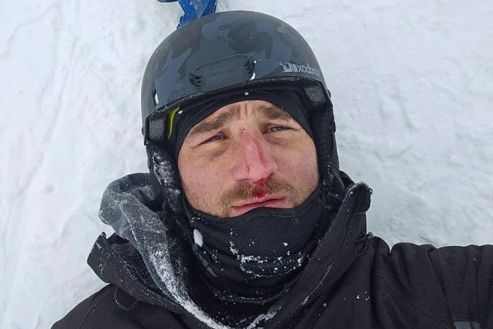 UFC Vegas 112 Fighter Carried Out of Octagon After KO Loss Leaves Her Unable to Walk