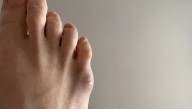 The Pinky Toe Has A Purpose And Most People Are Just Finding Out