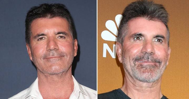 Simon Cowell Opens Up About 'Changing Face': 'I Looked Like A Weirdo’