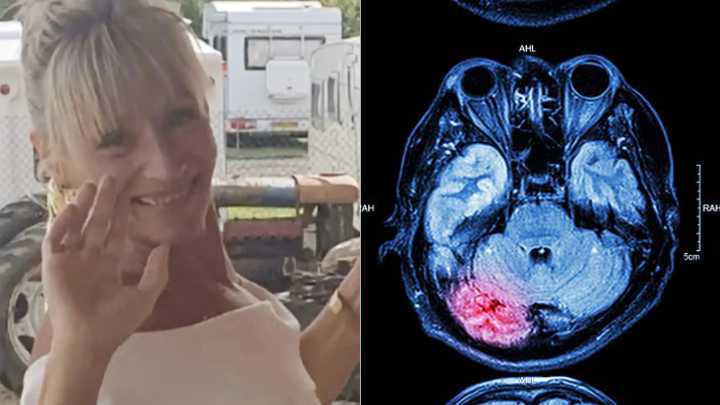 Mujer de 54 años convulsionó y fue trasladada a la morgue aunque todavía no había muerto; terminó falleciendo por daño cerebral