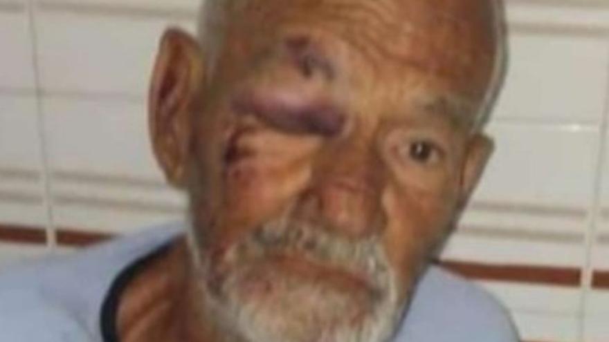 Búsqueda urgente en Gran Canaria: desaparece un hombre de 86 años desde hace más de una semana