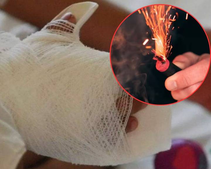 ¡Comenzó diciembre y ya hay quemados! Primer caso en Santa Marta que enciende las alarmas