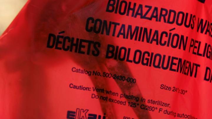 San Jose mortuary accused of mistakenly giving parent his son’s brain in bag