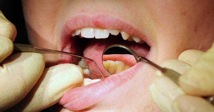 Government issues statement after concerns over NHS dentists waiting lists