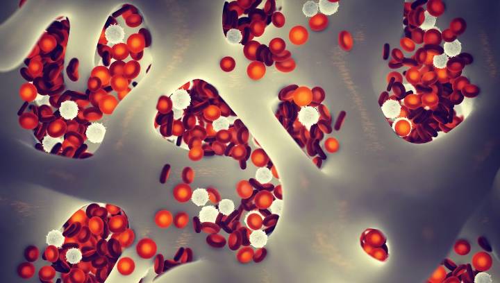 7th Person Now HIV-Free After Receiving Non-Resistant Stem Cell Transplant, Building Hope That Resistance Isn't Needed For A Cure