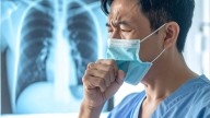 Think It’s Just Flu Or A Cold? This Cough Could Actually Be Covid