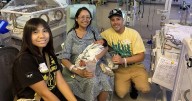 Cedars-Sinai team in Los Angeles delivers baby, removes 22-pound ovarian tumor in rare pregnancy
