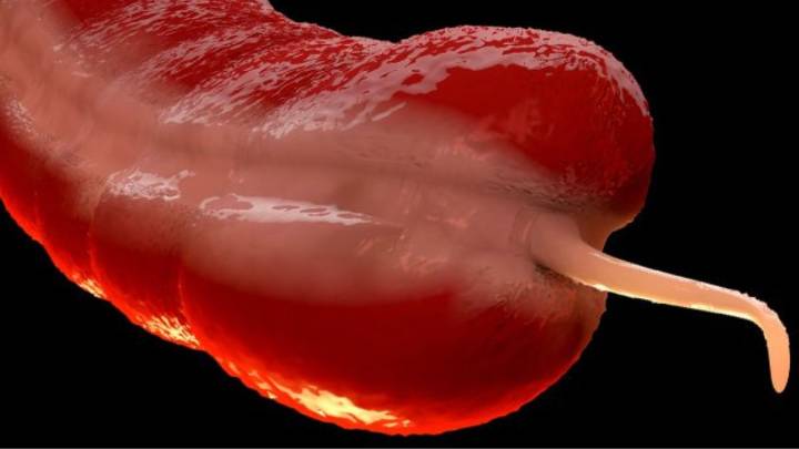 A Rare Cancer Is Surging in Young People, And Experts Are Puzzled