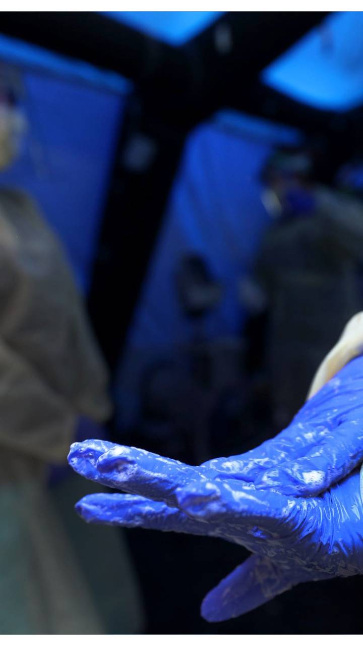 Flu cases surge across New York state