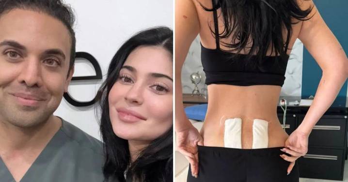 Kylie Jenner Reveals She Underwent Stem Cell Therapy After Childbirth Gave Her 'Chronic Back Pain'