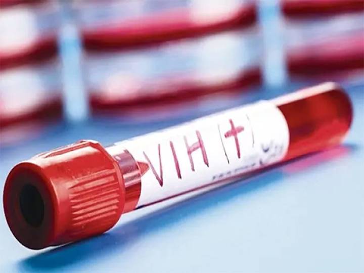 Sudáfrica presenta estudio nacional sobre estigma del VIH